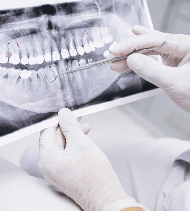 Especialistas en implantes dentales en Bilbao Clínica Dental MD